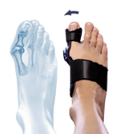 ValguLoc II, Supports & Orthoses, Bauerfeind, India